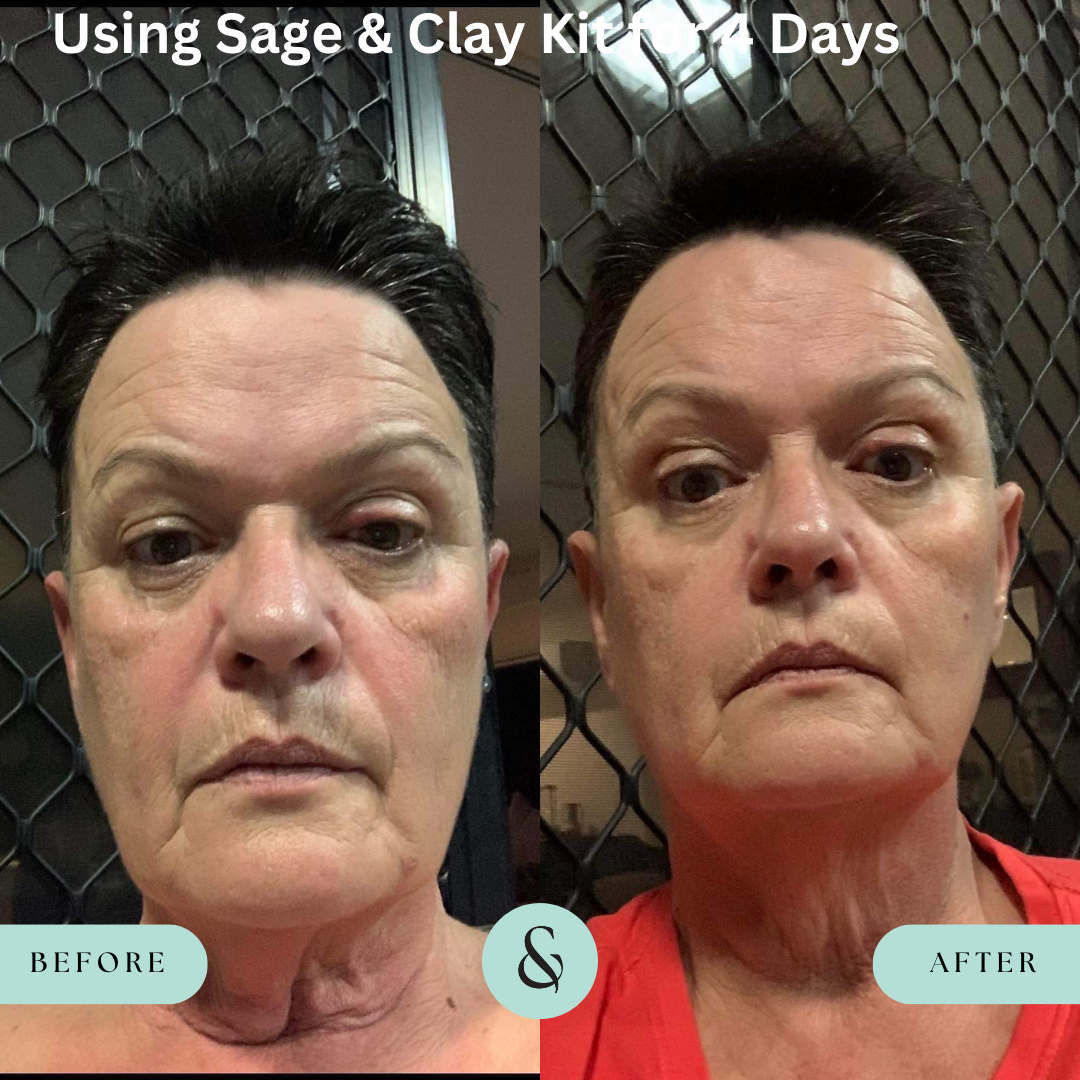Skin Care Bundle
