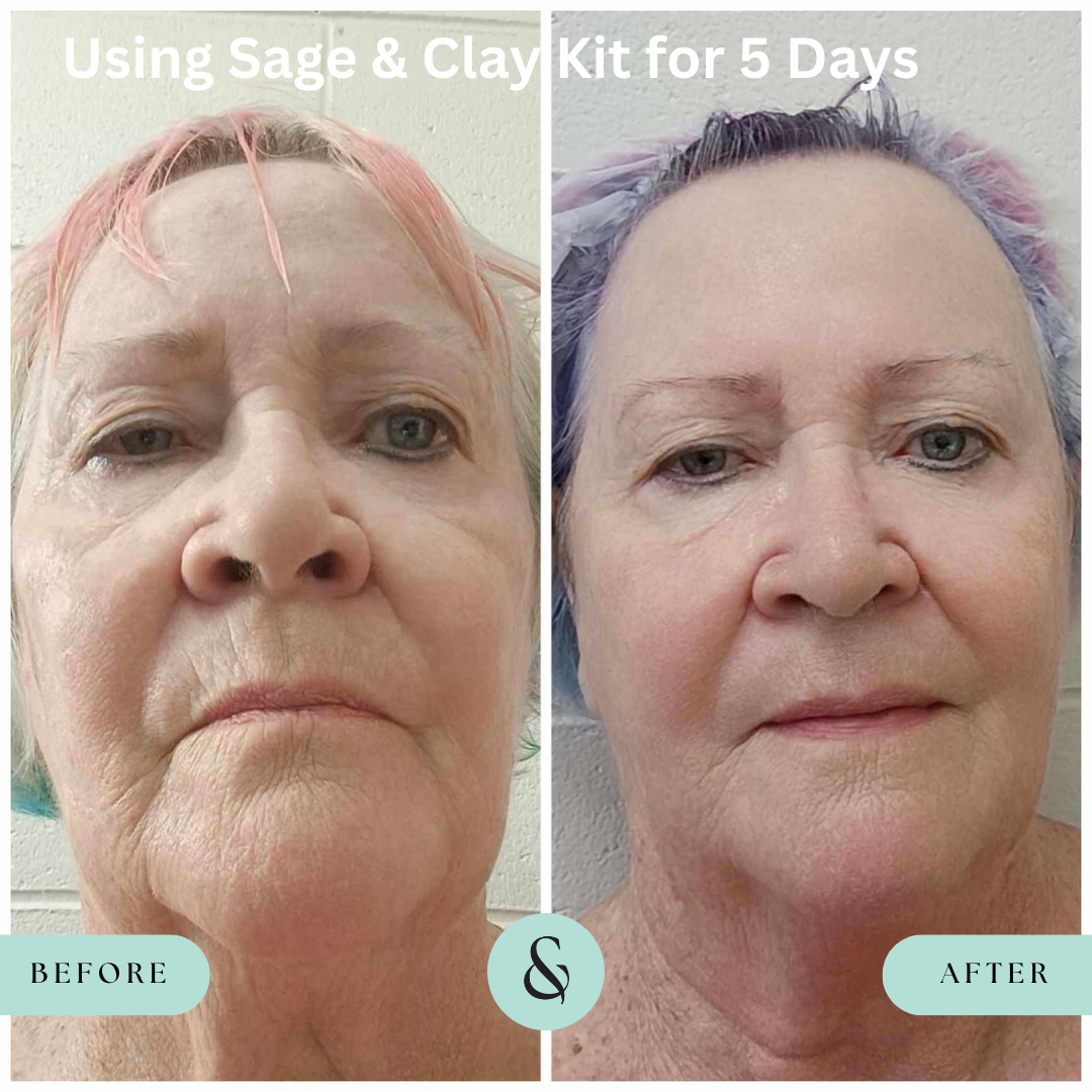 Skin Care Bundle