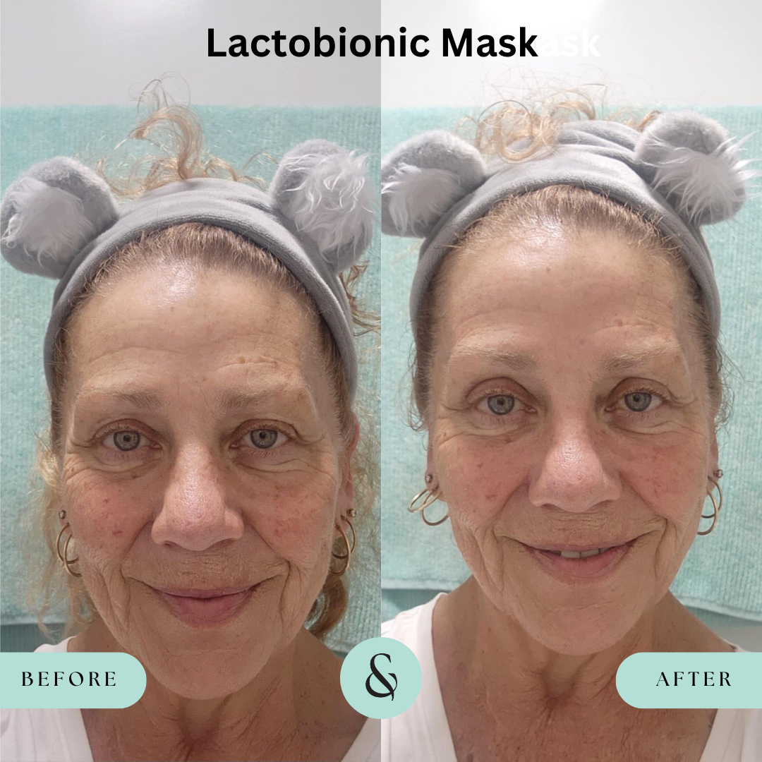 Skin Care Bundle